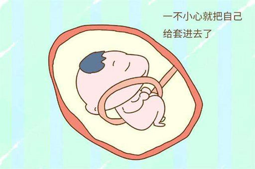 孕期预防胎儿脐带绕颈，需要做好这几点！