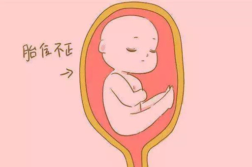 胎位不正怎么办？胎位不正有什么方法调整吗？